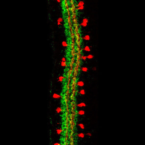 The Starburst Amacrine Cells of the Retina by Evelyn Aviles