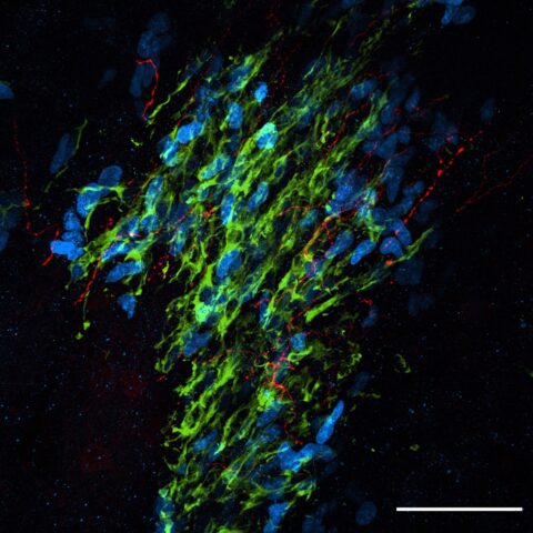 Serotonin fibers in the rostral migratory stream by Nikita Sturrock