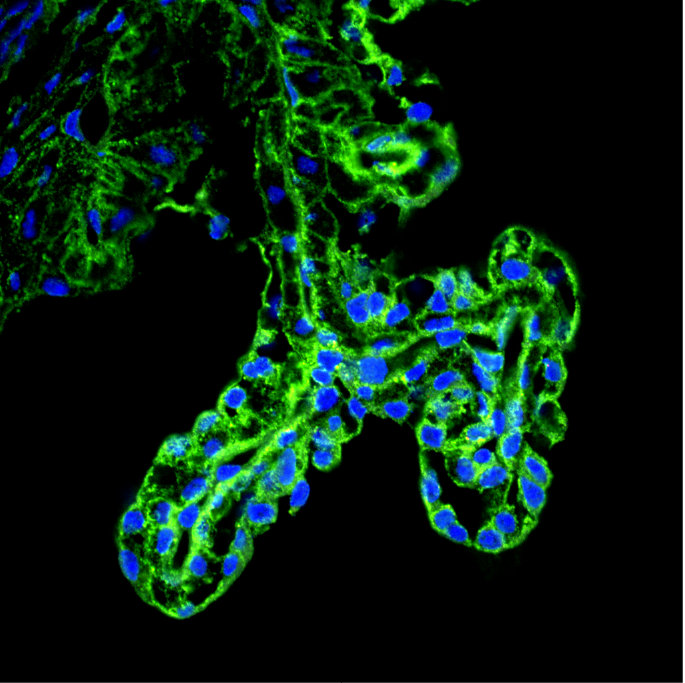 03_Ciliary Body