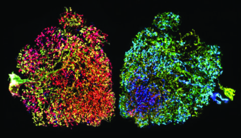 Local interneurons in the drosophila antennal lobe by Isabel D’Alessandro