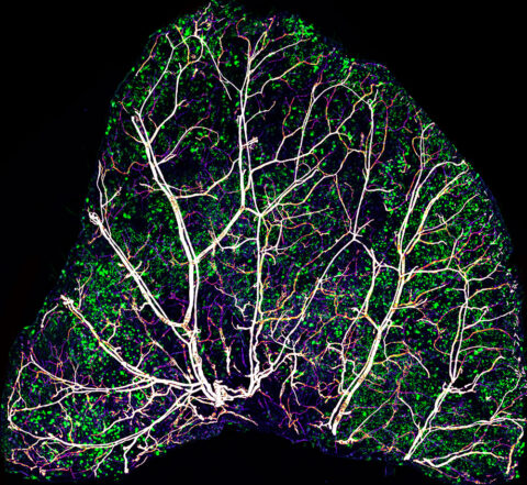 The skin of a mouse ear by Brian W. Chow