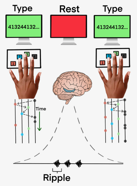 While learning a typing task, epilepsy patients got faster after brief rest breaks rather than while typing. There was a corresponding increase in hippocampal ripple rate that predicted these offline gains in speed.