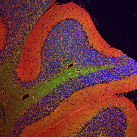 Distribution of N- and O-GalNAc Glycans in the Cerebellum by Maxence Noel