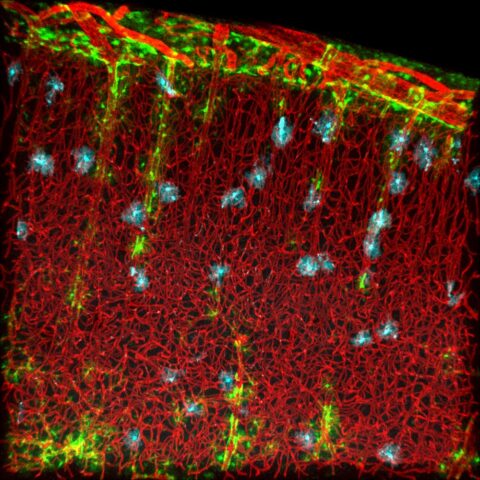 Astrocyte-blood vessel interaction by Urs Langen