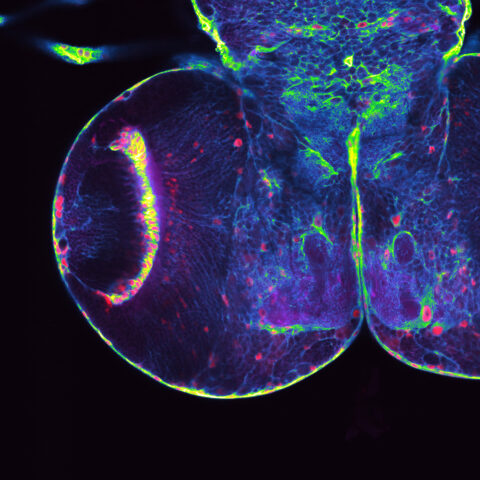 Brain Tumor of a Fruit Fly by Torrey Mandigo