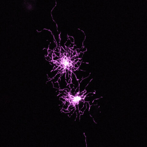 Neurofilaments by Evelyn Aviles