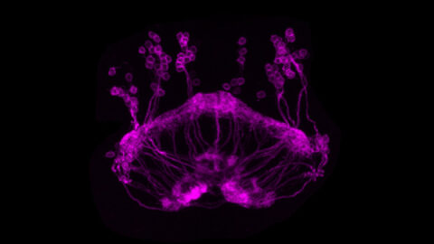 vDeltaA Neurons in the Fly Brain by Emily Kellog