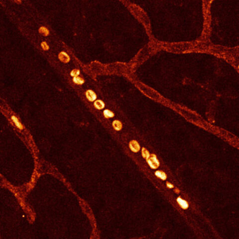 Red Blood Cells in Retina Vasculature by Swathi Ayloo