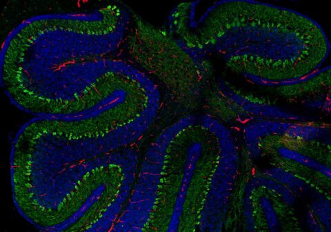 Purkinje Neurons in Cerebellum by Swathi Ayloo