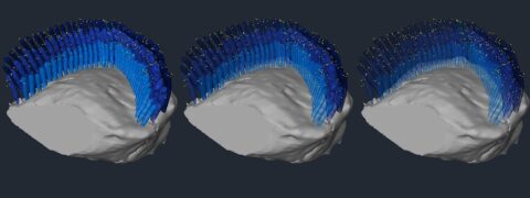 A 3D Reconstruction of an Anti-PKHD1L1 Immunogold Labeled OHC Stereocilia Bundle