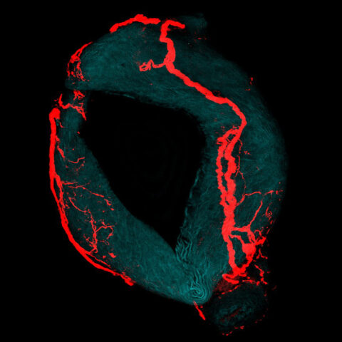 Neurons that Sense Blood Pressure in the Aortic Arch by Soohong Min