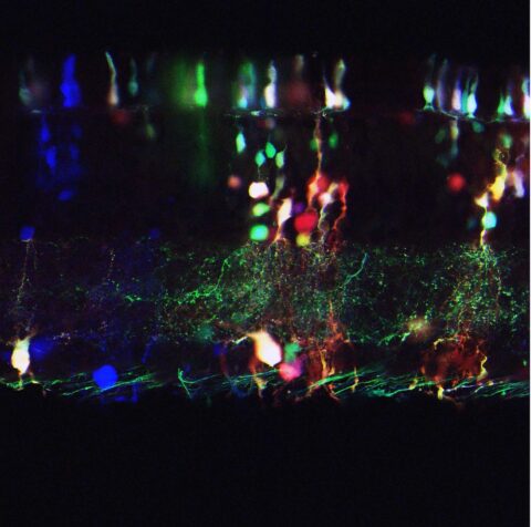 Chick Retina-Bow by Masahito Yamagata
