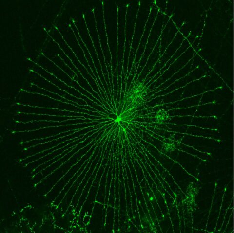 Wheel in Chick Retina by Masahito Yamagata