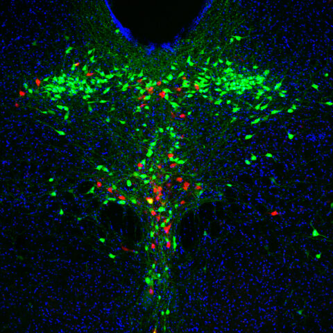 Coronal Section of the Dorsal Raphe Nucleus of a Mouse Midbrain by Olga Alekseyenko