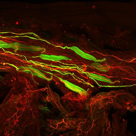 Touch-Sensitive Pacinian Corpuscles by Katelyn Comeau