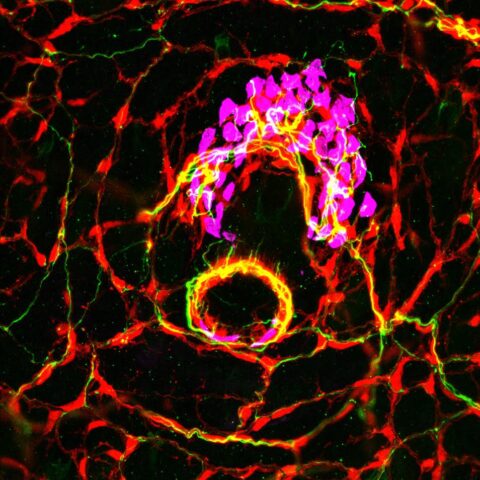 Innervation of a Hair Follicle by Touch-Sensitive Neurons by Katelyn Comeau