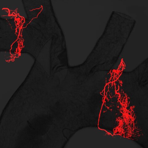 Neurons that Sense Blood Pressure in the Aortic Arch by Soohong Min