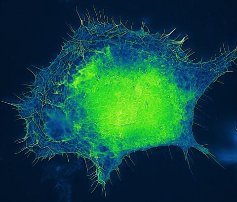 Actin Network Architecture of a Motor Neuron by Iván Coto Hernández