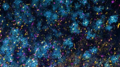 Gray Matter Galaxy by Ayush Noori and Clara Muñoz-Castro