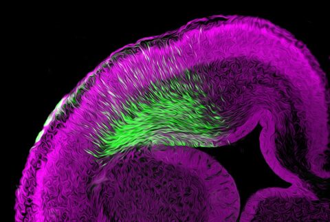 Migrating Neurons in Embryonic Mouse Cortex by Kadir Ozkan
