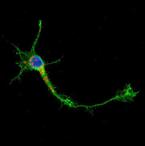 Trafficking of RNA Molecules to the Growth Cone by Kadir Ozkan