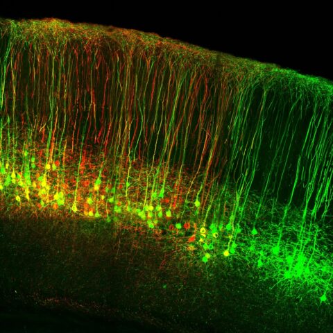 Cervical- and Lumbar-Projecting Corticospinal Neurons Carla Carol Winter