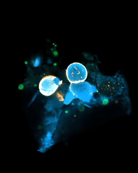 Before thought begins, the fetal brain performs its first selection, discarding fractured genomes to preserve the integrity of those destined to shape the self. Blue DNA escapes through the orange nuclear envelope of a developing neuron, forming micronuclei, tiny archives of genetic failure marked by green rupture signals.