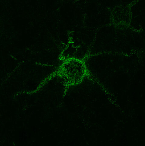 Perineuronal nets glowing green through fluorescent microscopy, emerging from the extracellular matrix-the biological scaffold underlying neural circuitry. These structures embody the brain's central dilemma: stability to lock in essential connections, or plasticity to rewire and evolve, a choice that shapes every neural network.