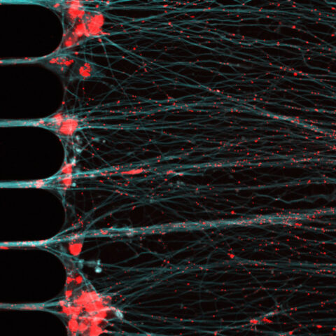 Confocal image reveals the complex beauty of human iPSC-derived cortical neurons cultured in a microfluidic chamber modelling Alzheimer’s disease. Fluorescently labelled neuronal RNA granules (red) travel along microtubule tracks (cyan), orchestrating the transport of translational machinery essential for localized protein synthesis, capturing both the precision and fragile elegance of neurons.