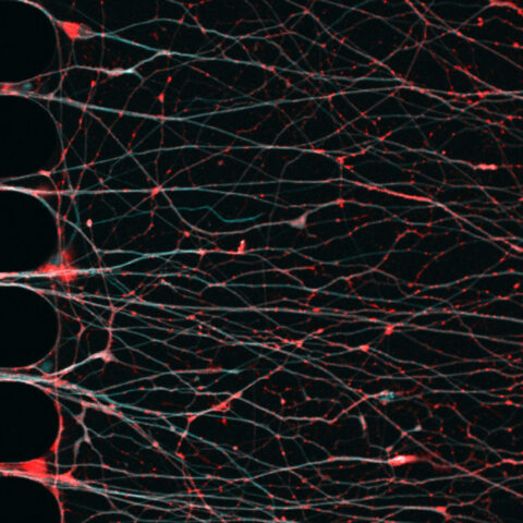 Confocal image reveals the complex beauty of human iPSC-derived cortical neurons cultured in a microfluidic chamber modelling Alzheimer’s disease. Fluorescently labelled neuronal RNA granules (red) travel along microtubule tracks (cyan), orchestrating the transport of translational machinery essential for localized protein synthesis, capturing both the precision and fragile elegance of neurons.