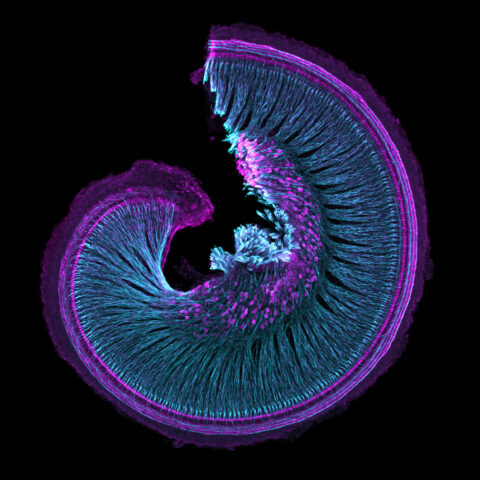 The mammalian cochlea is a spiral-shaped organ that mediates the sense of hearing with astounding precision. Here, auditory neurons are shown with their cell bodies in magenta, extending cyan axons to innervate sound-sensitive cells around the spiraling border of the tissue, also in magenta.