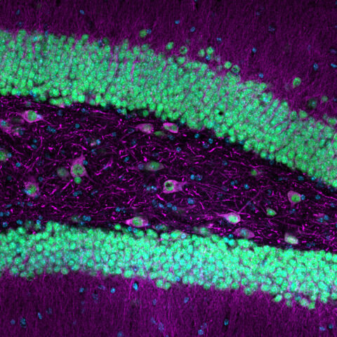 This confocal image captures neurons in the mouse dentate gyrus, a region of the mouse hippocampus where new neurons emerge and memories form. Neuronal dendrites and cell bodies (MAP2, magenta), neuronal nuclei (NeuN, green), and all cell nuclei (blue), are shown composing a fluorescent landscape of connectivity and growth.