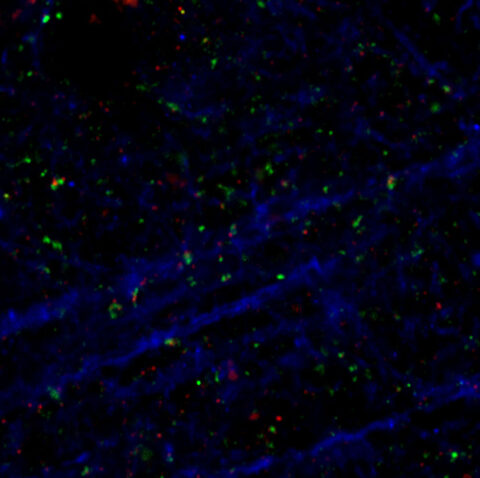This confocal image captures the balance that keeps the brain in tune. In the mouse frontal cortex, a delicate network of dendrites (blue) weaves together with inhibitory synapses marked by VGAT (green) and gephyrin (red). These vibrant threads of inhibition reveal the subtle architecture that tempers and fine tunes neural activity to maintain balance within the brain’s circuitry.