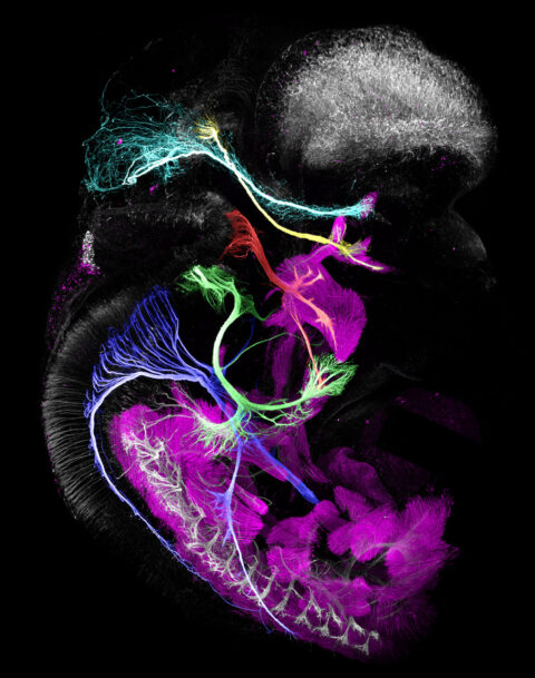 Outgrowth of the developing cranial motor nerves in an embryonic mouse at embryonic day 12.5. Cranial nerves are segmented and pseudocolored to allow for tracking of the nerves from their nuclei in the brain as they grow out towards their target muscles.