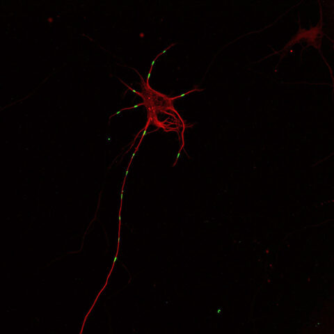A map of a growing neuron's molecular highways. Microtubules (red) make up the neuron's structural support and transportation routes. Patches of microtubules (green) have been converted to a different color to track their movements.