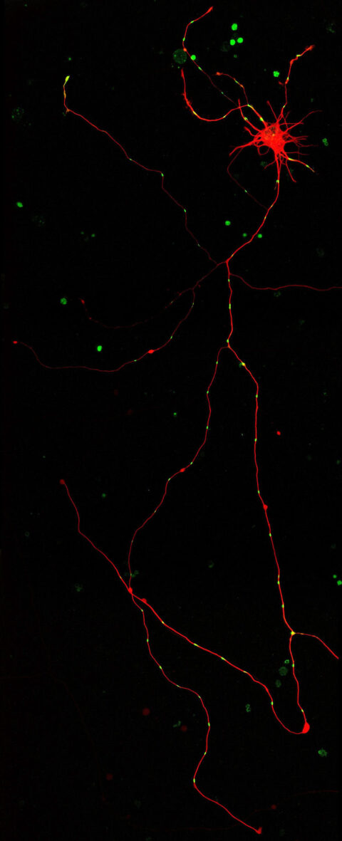 A map of a growing neuron's molecular highways. Microtubules (red) make up the neuron's structural support and transportation routes. Patches of microtubules (green) have been converted to a different color to track their movements.