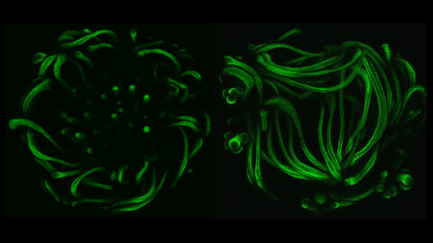 Front and back views of a human stem-cell-derived skin organoid. Fluorescent labeling reveals green hair follicles swirling like Medusa’s curls as the tissue self-organizes.