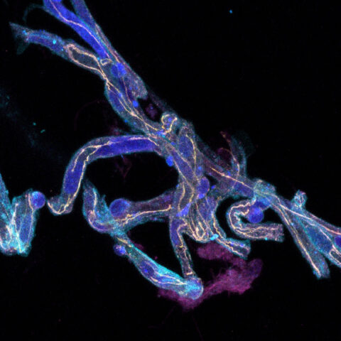 An isolated microvessel (a tiny blood vessel) from donated human brain, highlighted in light blue (using a cell membrane stain, Concanavalin-A). In yellow, you can see the 