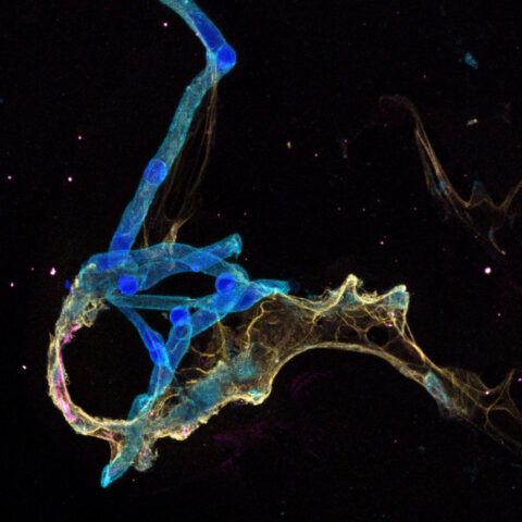 An isolated microvessel (a tiny blood vessel) from donated human brain, highlighted in light blue (using a cell membrane stain, Concanavalin-A). An astrocyte is hugging this microvessel, highlighted in yellow (stained for GFAP, an astrocyte marker). This image shows the intimate interactions between two different cell types in the brain.