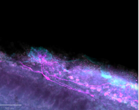 This image depicts a bundle of axon fibers called a glomerulus (pictured in cyan) that serves as a compile + relay center for olfactory information. The neurons (pictured in magenta) are the projection neurons that transmit the information from this relay to high brain structures.