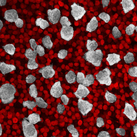 In white are mouse retinal ganglion cells, the output neurons of the eye that communicate with the brain. In red are retinal bipolar cells, interneurons which relay information from photoreceptors to retinal ganglion cells.