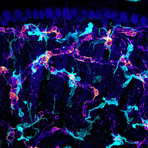 In the inner ear, immune cells make very close contact with pericytes, cells that wrap around blood vessels so small that red blood cells have to pass though in single file. These vessels weave through neuron fibers as they reach out to hair cells that sense vibration (top).