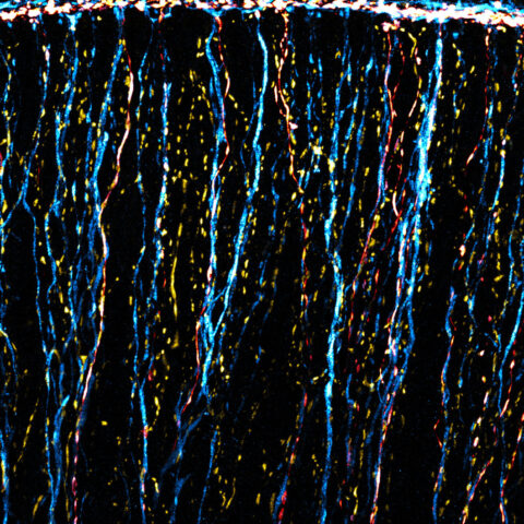 In the inner ear, three populations of feedback neurons intermingle with the fibers of auditory neurons to change how our ears respond to stimuli. Their axons display a range of appearances but still are very organized, bringing to mind strings of holiday lights of different colors all arranged with care.