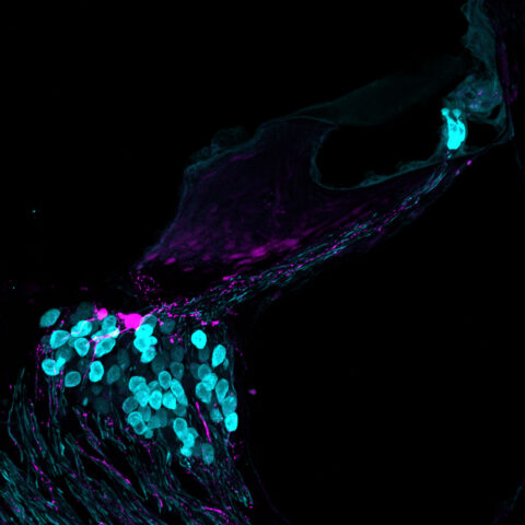 A cross-section of the mouse cochlea, the organ that detects auditory information. Sound-receiving inner hair cells and hearing-related neurons are shown in cyan, with brightness differences indicating varying expression levels. Pain-sensing neurons are labeled in magenta, revealing the mixture of sensory cells within the cochlea.