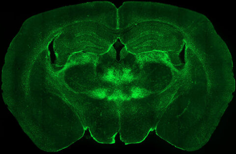 A coronal slice of an adult mouse brain showing antibody staining for glial fibrillary acidic protein (GFAP), which labels reactive astrocytes in the adult brain.