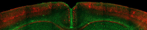 A coronal section of an adult mouse brain. Green staining marks astrocytes expressing glial fibrillary acidic protein (GFAP), while red indicates the expression of a cell membrane-targeted protein in layer 2/3 cortical neurons.