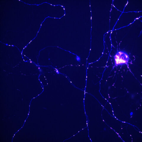 Glowing mitochondria dot the long branches of neurons, highlighting the cell’s internal transport system. These mobile energy producers travel up and down the neuron to keep it functioning, powering the signals that allow brain cells to communicate over remarkable distances.