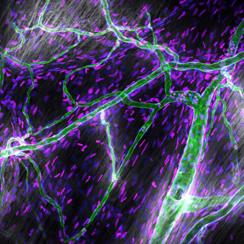 The dura is the outermost layer of the meninges, a membrane that covers and protects the brain. This image shows a small molecular tracer NHS-biotin (gray) leaking out of blood vessels (green) in the dura. All cell nuclei are stained in blue. Magenta labels a histone modification that is associated with transcriptionally inactive DNA.