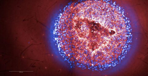 A patient induced pluripotent stem cell-derived neuroepithelial organoid. Neuroepithelial stem cells self-organize in a columnar-like fashion around a central cavity (lumen). This process mimics the early spatial organization of the developing neural tube. Live 3D cell imaging highlights Plasma membranes (Red) and Nuclei (Blue).