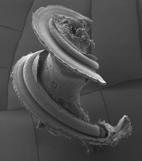 Scanning Electron Microscopy (SEM) image of the cochlea, the hearing organ, of a postnatal day 7 wild type mouse. This delicate structure is encased in the temporal bone of the skull and contains the specialized sensory cells (hair cells) and neurons (spiral ganglion neurons) that send sounds to the brain for downstream processing.